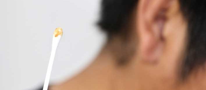 How Do You Remove Ear Wax Naturally