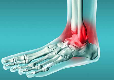 What Causes Pain in the Foot?